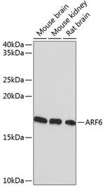 ARF6 Recombinant Rabbit Monoclonal Antibody (9E7T9)