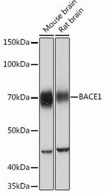 BACE1 Recombinant Rabbit Monoclonal Antibody (7C5T7)