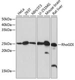 RhoGDI Recombinant Rabbit Monoclonal Antibody (0D6X5)