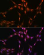 GSS Recombinant Rabbit Monoclonal Antibody (2S9W7)