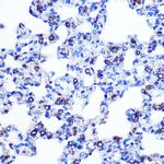 Monoamine Oxidase B Antibody in Immunohistochemistry (Paraffin) (IHC (P))