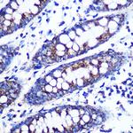 Monoamine Oxidase B Antibody in Immunohistochemistry (Paraffin) (IHC (P))