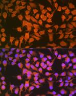 CBS Recombinant Rabbit Monoclonal Antibody (1R2E9)