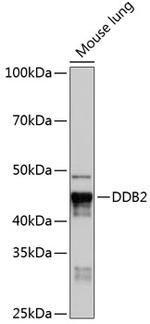 DDB2 Antibody in Western Blot (WB)