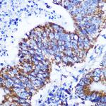 COX4 Recombinant Rabbit Monoclonal Antibody (3P8J2)