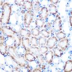 RHAMM Antibody in Immunohistochemistry (Paraffin) (IHC (P))