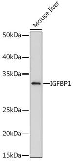 IGFBP-1 Recombinant Rabbit Monoclonal Antibody (2A0B5)