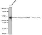 AZGP1 Antibody in Western Blot (WB)