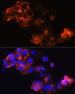 Glypican 3 Antibody in Immunocytochemistry (ICC/IF)