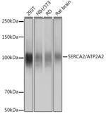 SERCA2 ATPase Recombinant Rabbit Monoclonal Antibody (10F0M9)