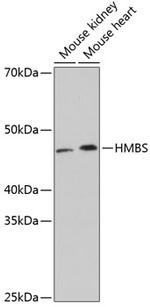 HMBS Antibody in Western Blot (WB)