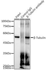 beta Tubulin Antibody in Immunoprecipitation (IP)