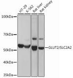 GLUT2 Recombinant Rabbit Monoclonal Antibody (2V2U2)