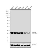 RAB7 Antibody in Western Blot (WB)
