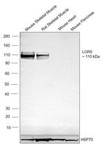 LGR5 Recombinant Rabbit Monoclonal Antibody (9J9B8)