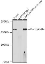 Dot1L Antibody in Immunoprecipitation (IP)
