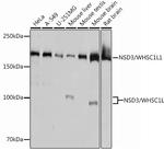 NSD3 Recombinant Rabbit Monoclonal Antibody (3U4F9)
