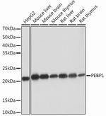 PEBP1 Recombinant Rabbit Monoclonal Antibody (1X2G1)