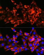 HSPB8 Recombinant Rabbit Monoclonal Antibody (3K10W1)