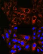 HSPB8 Antibody in Immunocytochemistry (ICC/IF)