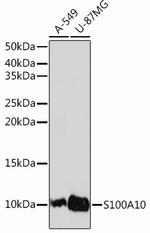 S100A10 Antibody in Western Blot (WB)