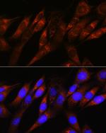PDHA1 Recombinant Rabbit Monoclonal Antibody (8Z4N6)