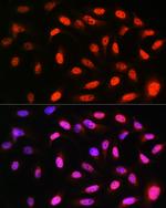 VCP Antibody in Immunocytochemistry (ICC/IF)