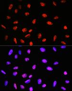 PABPN1 Antibody in Immunocytochemistry (ICC/IF)