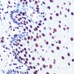 PABPN1 Antibody in Immunohistochemistry (Paraffin) (IHC (P))