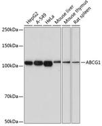 ABCG1 Recombinant Rabbit Monoclonal Antibody (4Y7B3)