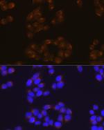 Amyloid Precursor Protein Recombinant Rabbit Monoclonal Antibody (3A8S2)