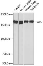 Protein APC Recombinant Rabbit Monoclonal Antibody (8X7Q1)