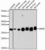 SDHB Recombinant Rabbit Monoclonal Antibody (9S1A0)