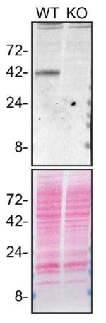 Cathepsin B Antibody