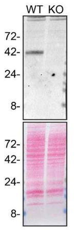 Cathepsin B Antibody in Western Blot (WB)