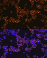 CD14 Recombinant Rabbit Monoclonal Antibody (0F2Q7)