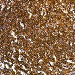 CD45 Antibody in Immunohistochemistry (Paraffin) (IHC (P))