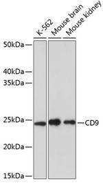 CD9 Recombinant Rabbit Monoclonal Antibody (10N2L6)