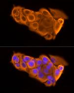 Cytokeratin 19 Antibody in Immunocytochemistry (ICC/IF)