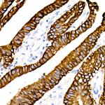 Cytokeratin 19 Antibody in Immunohistochemistry (Paraffin) (IHC (P))