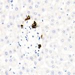Cytokeratin 19 Antibody in Immunohistochemistry (Paraffin) (IHC (P))
