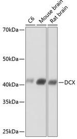 Doublecortin Recombinant Rabbit Monoclonal Antibody (6H1B3)