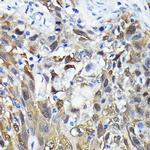 4EBP1 Antibody in Immunohistochemistry (Paraffin) (IHC (P))