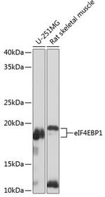 4EBP1 Antibody in Western Blot (WB)