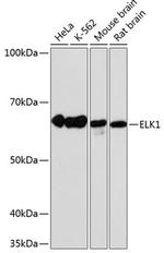 ELK1 Recombinant Rabbit Monoclonal Antibody (10U8X1)