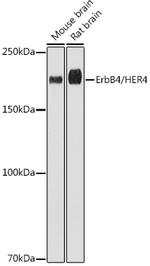 ErbB4 Recombinant Rabbit Monoclonal Antibody (8E5D0)