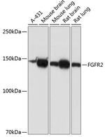 FGFR2 Recombinant Rabbit Monoclonal Antibody (0O6A9)