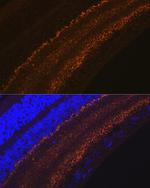 GAP43 Recombinant Rabbit Monoclonal Antibody (8E7C8)