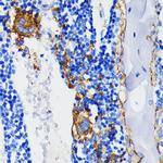 CD61 (Integrin beta 3) Antibody in Immunohistochemistry (Paraffin) (IHC (P))