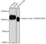 CD61 (Integrin beta 3) Antibody in Western Blot (WB)